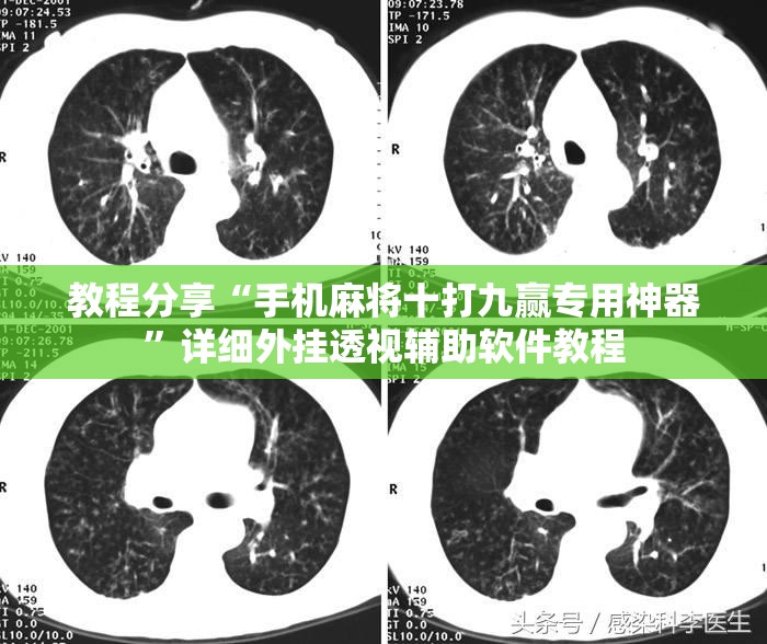 教程分享“手机麻将十打九赢专用神器”详细外挂透视辅助软件教程