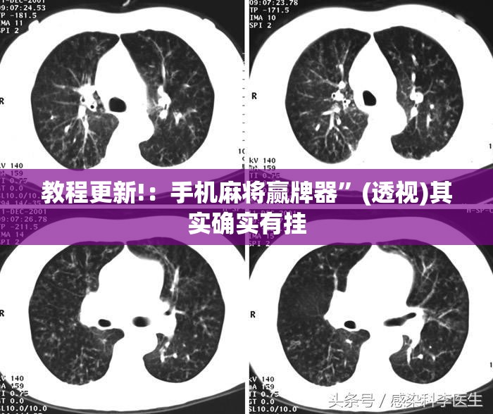 教程更新!：手机麻将赢牌器	”(透视)其实确实有挂
