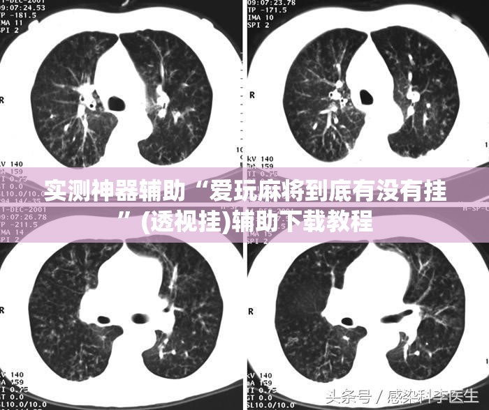 实测神器辅助“爱玩麻将到底有没有挂	”(透视挂)辅助下载教程